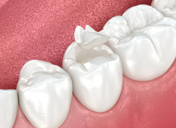 Best Dentures (Full and Partial)  in USA